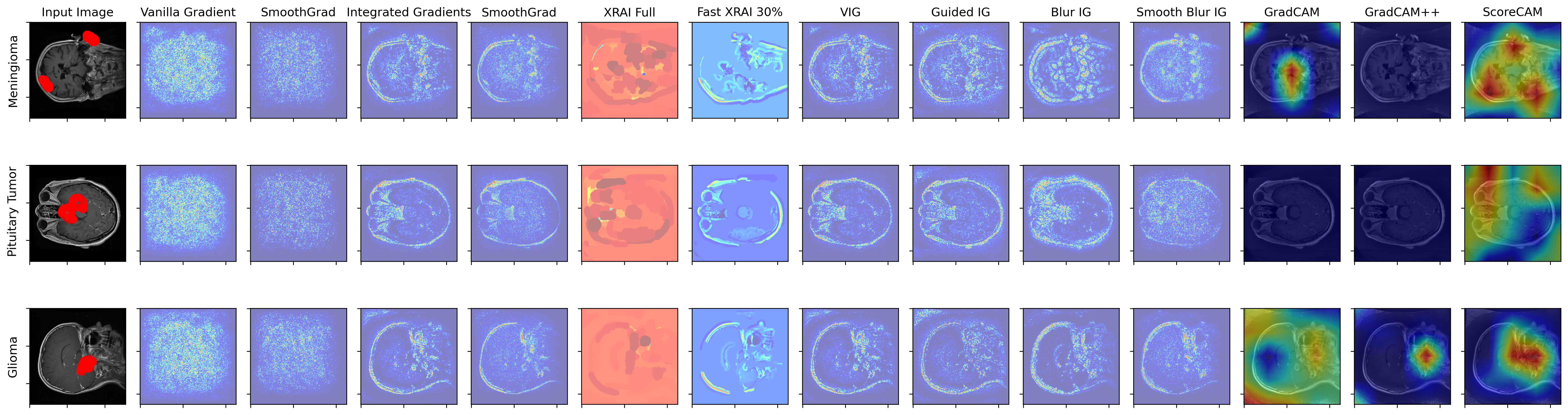 Explainable AI in Medical Image Analysis